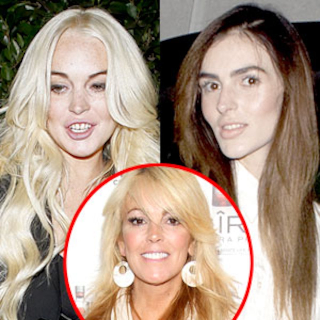 Dr Robert Rey It Does Appear Ali Lohan May Have Had Work Done E Online Uk